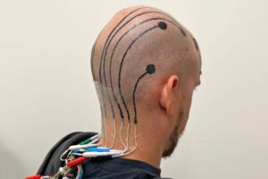 Temporary scalp tattoo can be used to record brain activity