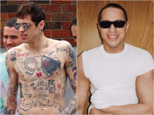 Pete Davidson’s Post-Tattoo-Removal Photos Will Blow Your Mind