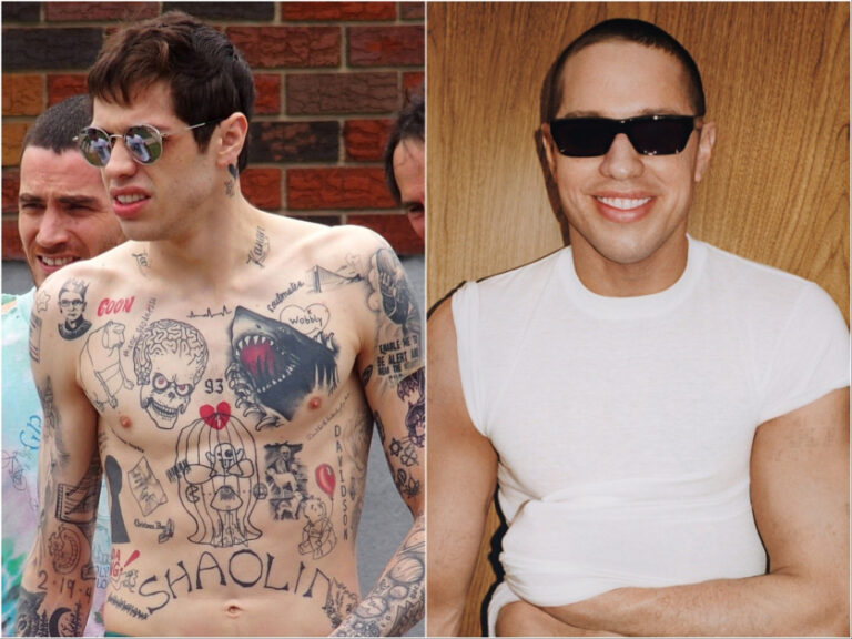 Pete Davidson’s Post-Tattoo-Removal Photos Will Blow Your Mind