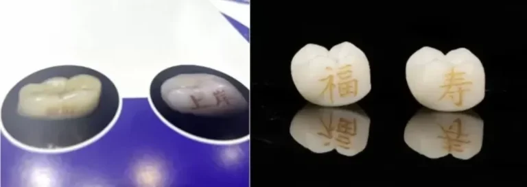 Bored with Skin Tattoos, Chinese Youths Are Increasingly Turning to Tooth Tattoos Instead