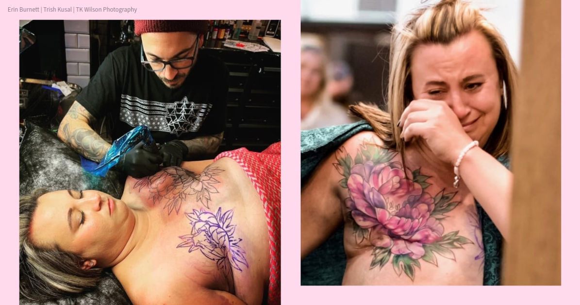 After 5 Failed Breast Reconstructions, I’m Finally Obsessed With My Cleavage Again