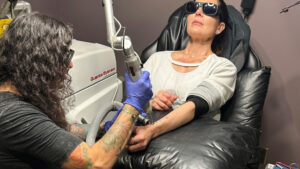 Laser tattoo removal takes longer, costs more and is more painful than getting inked