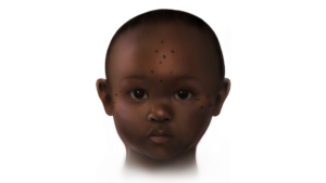 1,400 years ago, Nubians tattooed their toddlers. Archaeologists are trying to figure out why.